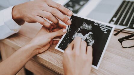 Ultrasound