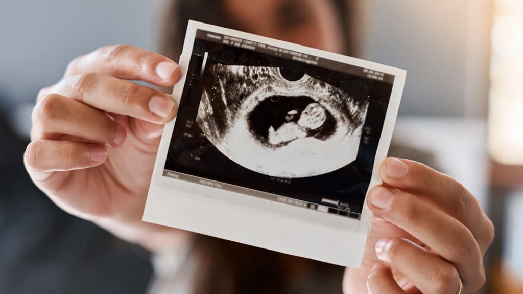 Ultrasound