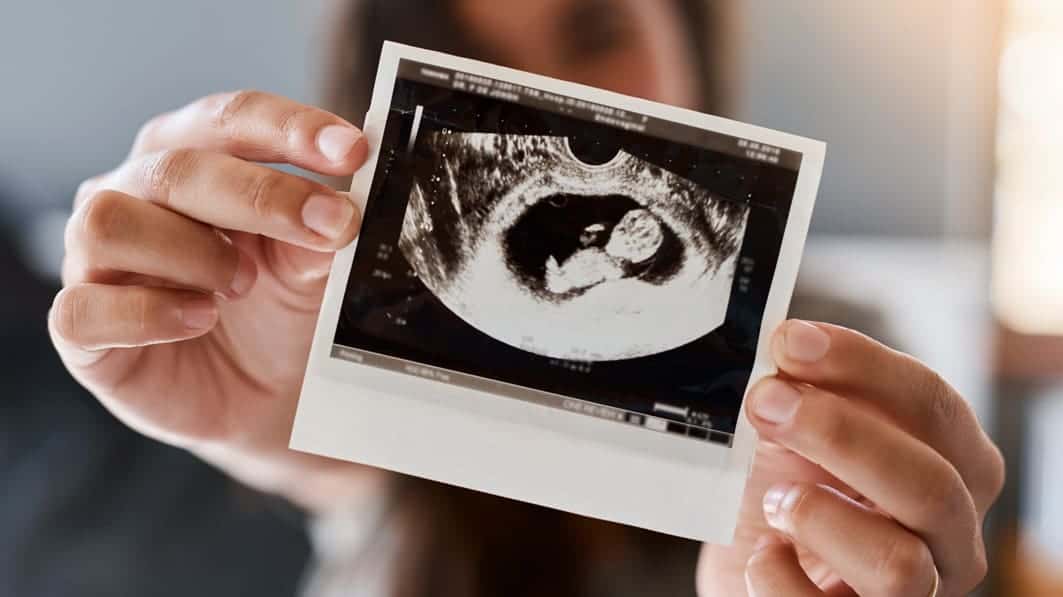 Ultrasound