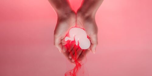 Abortion