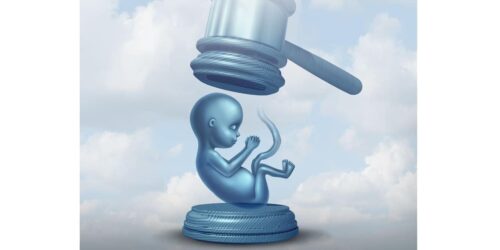 Late-term abortion
