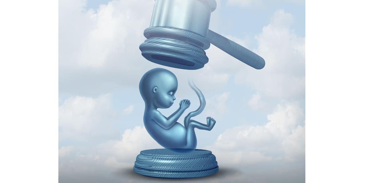 Late-term abortion