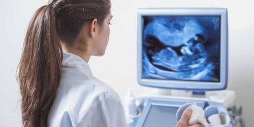 Ultrasound machine
