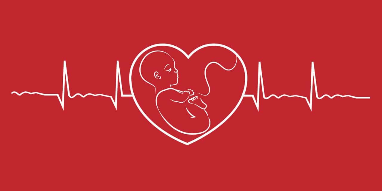 Baby's heart beat