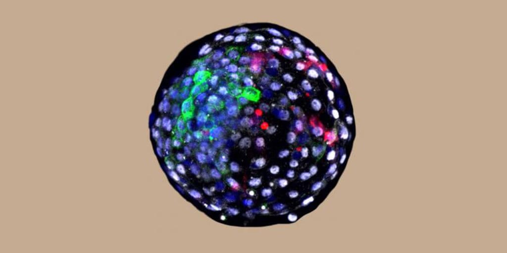 Monkey Human embryo