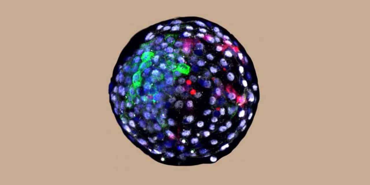 Monkey Human embryo