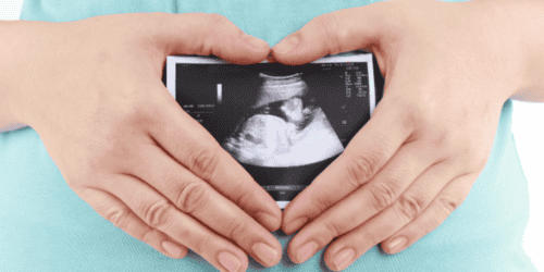 Pro-life