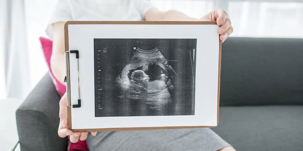 Baby ultrasound