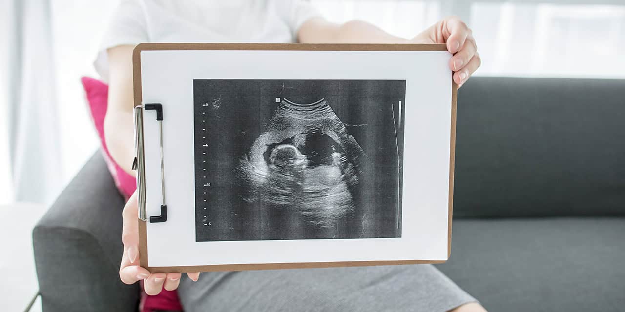 Baby ultrasound