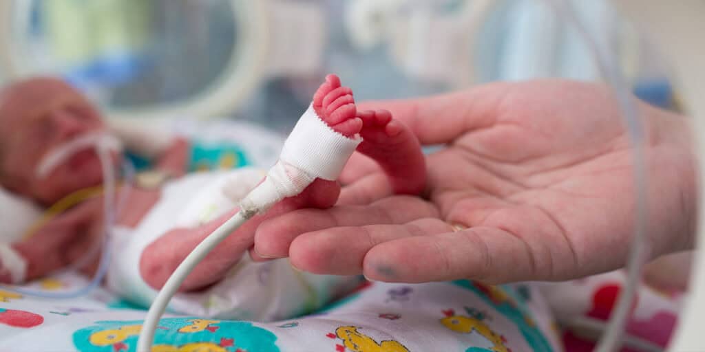 Premature baby