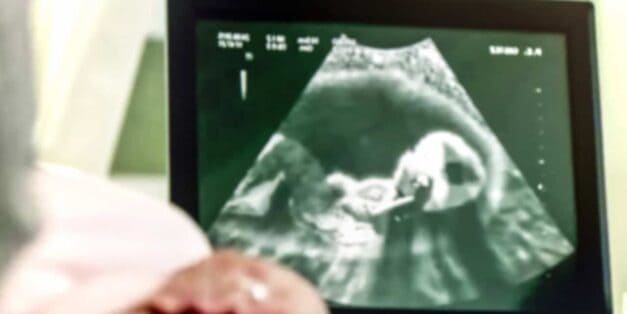 Baby ultrasound
