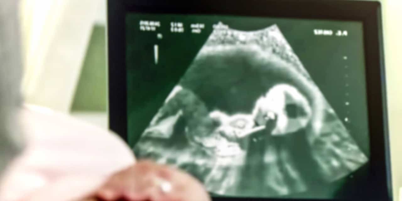 Baby ultrasound
