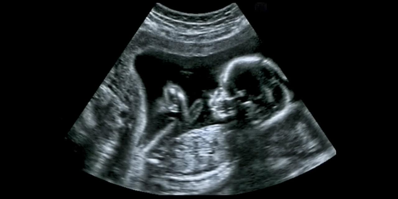 Baby ultrasound