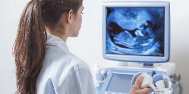 Ultrasound machine