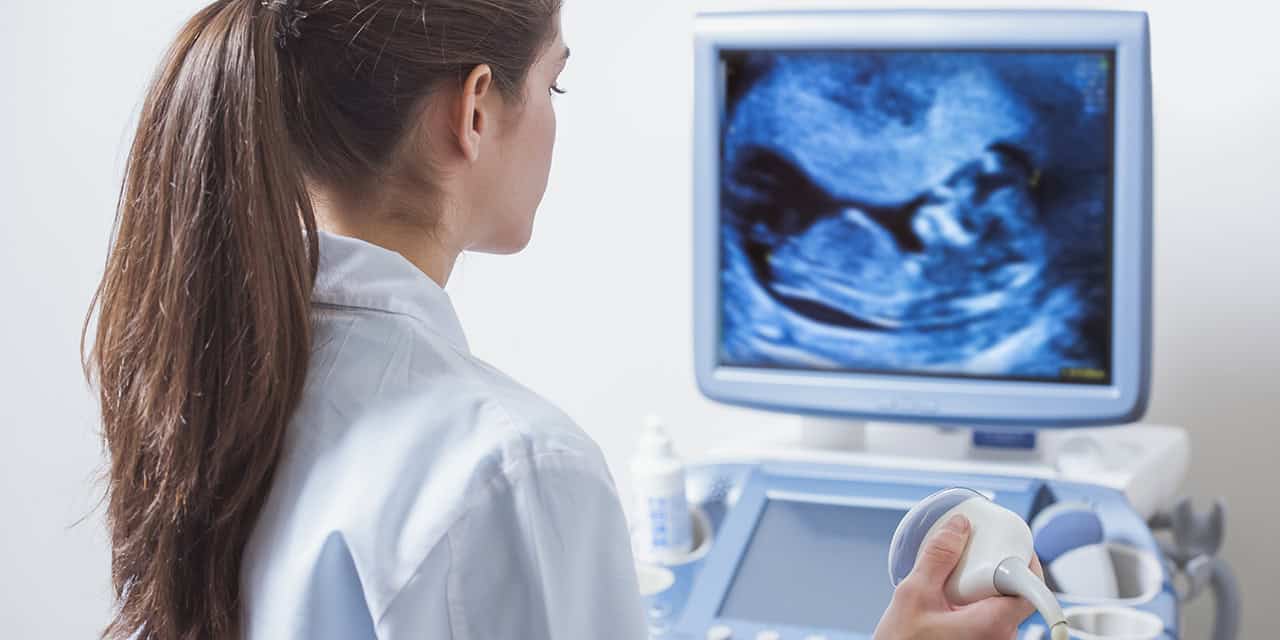 Ultrasound machine